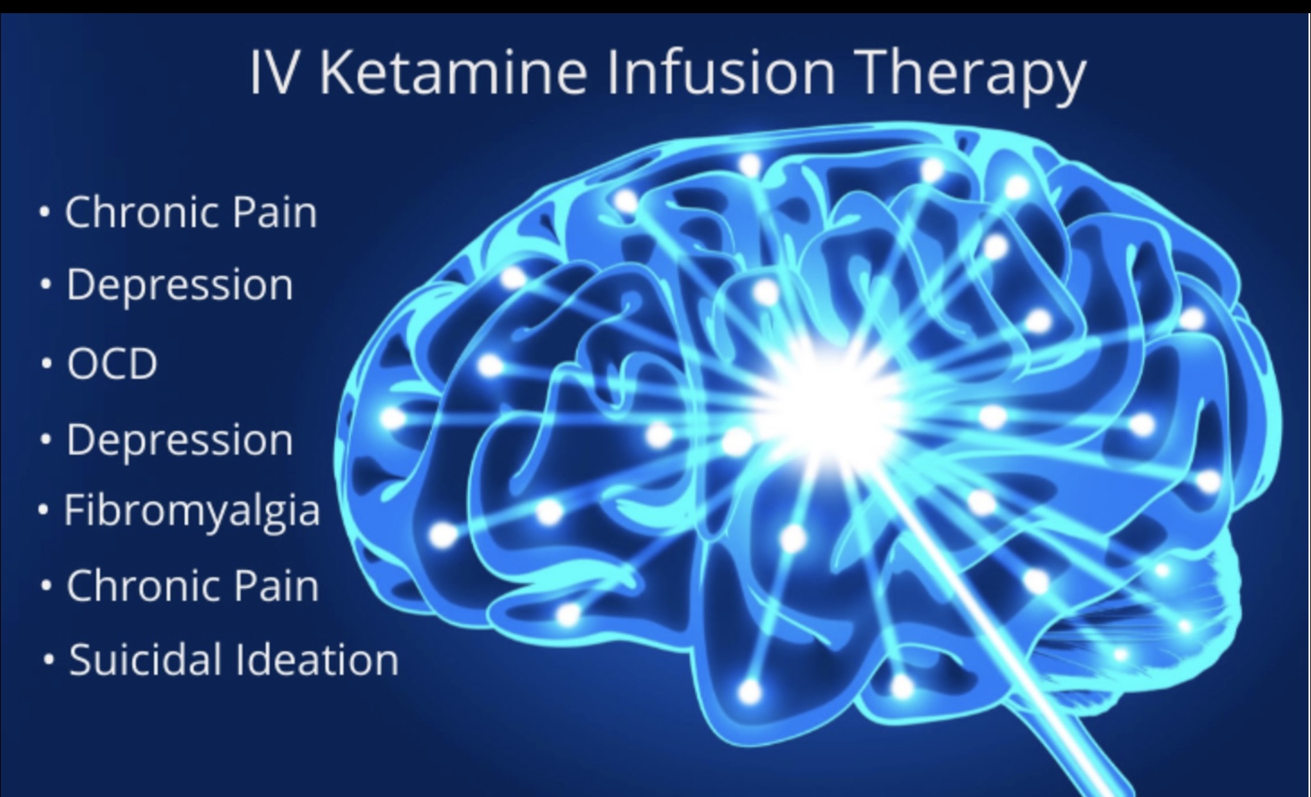 Jeff K – Ketamine