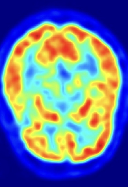 Saad – Default Mode Network
