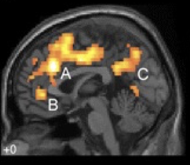 Ewa- Mindfulness &&nbsp;Neurobiology